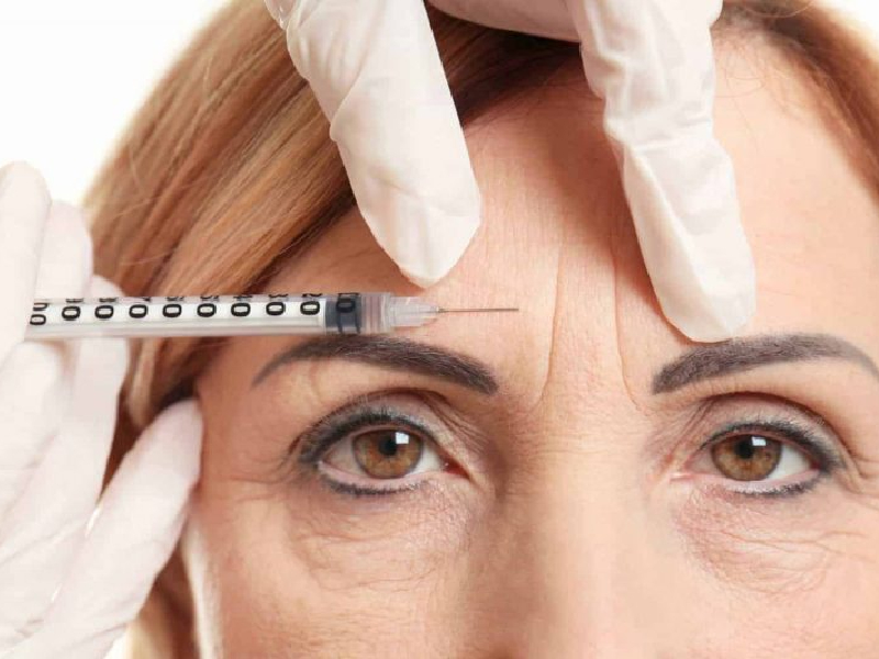 Forehead Lines Treatment
